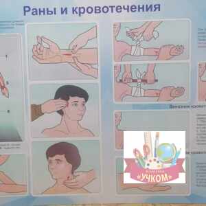 Стенд "Раны и кровотечения"